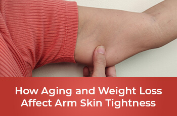Arm Skin Tightness